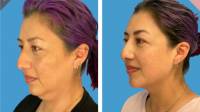 Cosmetic Surgery Services